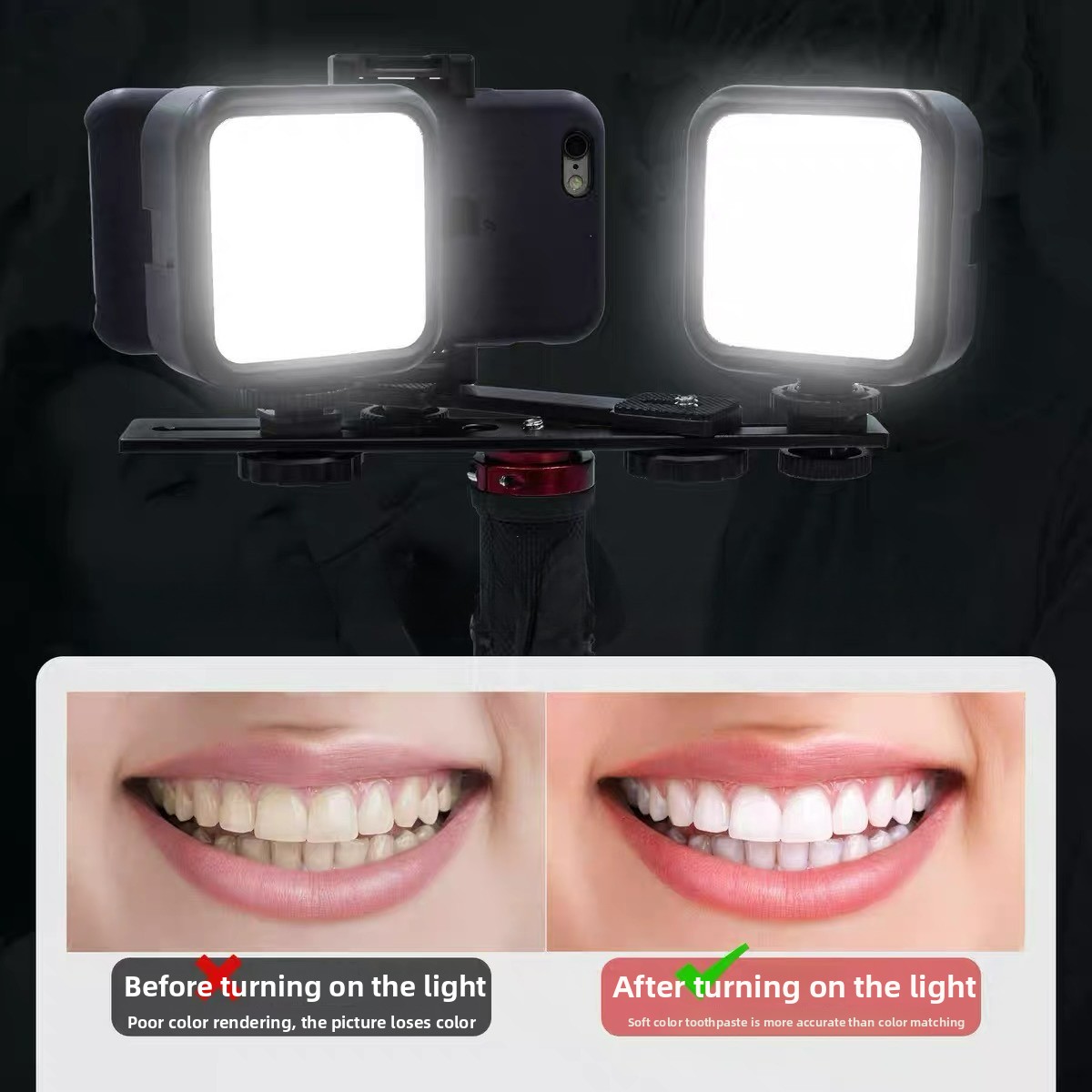 Dental Photography Light with  - Photography Basics 评论和价格